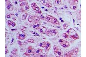 Image no. 1 for anti-Bone Marrow Stromal Cell Antigen 2 (BST2) (AA 80-130) antibody (ABIN960102) (BST2 anticorps  (AA 80-130))