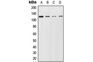 Western blot analysis of GCFC2 expression in HeLa (A), SP2/0 (B), PC12 (C) whole cell lysates. (GCFC2 anticorps  (Center))
