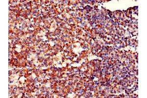 Immunohistochemistry of paraffin-embedded human tonsil tissue using ABIN7142365 at dilution of 1:100