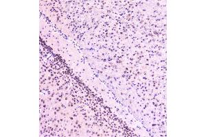 IHC analysis of Rad51 using anti-Rad51 antibody (ABIN6719396). (RAD51 anticorps)