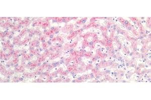 Detection of SAA in Human Liver Tissue using Monoclonal Antibody to Serum Amyloid A (SAA)