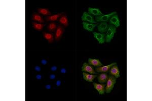 Brachyury / Bry Antibody staining Hela cells by IF/ICC.
