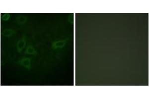 Immunofluorescence analysis of HepG2 cells, using TK (Ab-13) Antibody. (TK (AA 1-50) anticorps)