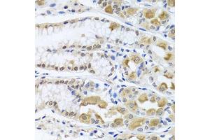 Immunohistochemistry of paraffin-embedded human stomach using TRMT1 antibody (ABIN5975089) at dilution of 1/100 (40x lens). (TRMT1 anticorps)