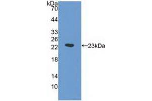 Western Blot; Sample: Recombinant a1AGP, Human. (ORM1 anticorps  (AA 19-201))