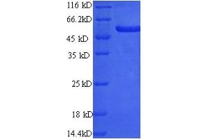 SDS-PAGE (SDS) image for Preferentially Expressed Antigen in Melanoma (PRAME) (AA 1-509), (full length) protein (His tag) (ABIN5710139)