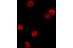 ABIN6275603 staining Hela by IF/ICC. (SF3B3 anticorps  (C-Term))