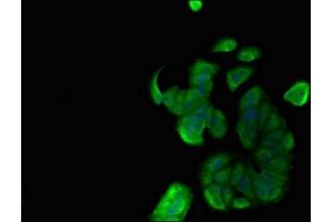 Immunofluorescent analysis of MCF-7 cells using ABIN7160462 at dilution of 1:100 and Alexa Fluor 488-congugated AffiniPure Goat Anti-Rabbit IgG(H+L) (MNDA anticorps  (AA 84-233))
