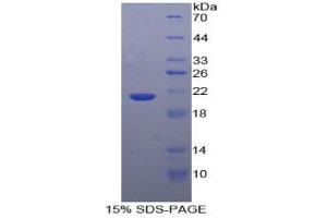 SDS-PAGE analysis of Human GaA Protein. (GAA Protéine)
