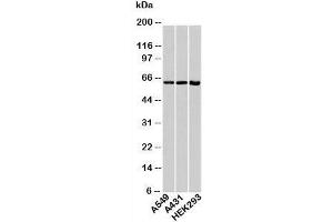 Western blot testing of human samples with HSP60 antibody at 1ug/ml. (HSPD1 anticorps)