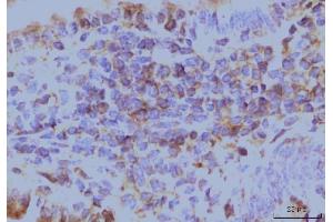 IHC analysis of EIF4A1 using anti-EIF4A1 antibody (ABIN7603144). (EIF4A1 anticorps  (N-Term))