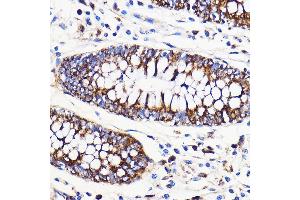 Immunohistochemistry of paraffin-embedded Human colon using Mitofusin 2 Rabbit pAb (ABIN6133825, ABIN6143800, ABIN6143803 and ABIN6216518) at dilution of 1:100 (40x lens).