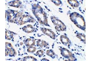 Image no. 2 for anti-Phorbol-12-Myristate-13-Acetate-Induced Protein 1 (PMAIP1) (N-Term) antibody (ABIN318707) (NOXA anticorps  (N-Term))