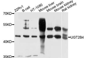 Western blot analysis of extracts of various cell lines, using μgT2B4 antibody (ABIN5972312) at 1/1000 dilution. (UGT2B4 anticorps)