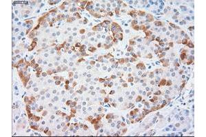 Immunohistochemistry (IHC) image for anti-Keratin 18 (KRT18) (AA 69-372) antibody (ABIN1491638) (Cytokeratin 18 anticorps  (AA 69-372))