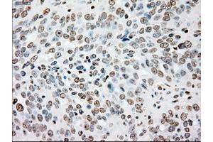 Image no. 11 for anti-Sjogren Syndrome Antigen B (SSB) antibody (ABIN1501146)