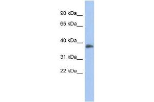 WB Suggested Anti-FOXB1 Antibody Titration:  0. (FOXB1 anticorps  (Middle Region))