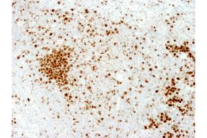Immunohistochemistry (IHC) image for anti-Antigen Identified By Monoclonal Antibody Ki-67 (MKI67) (AA 1650-1700) antibody (ABIN7448620)