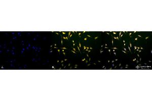 Immunocytochemistry/Immunofluorescence analysis using Rabbit Anti-Rab5 Polyclonal Antibody .