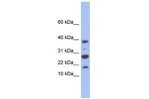 WB Suggested Anti-NDUFC1 Antibody Titration: 0. (NDUFC1 anticorps  (Middle Region))