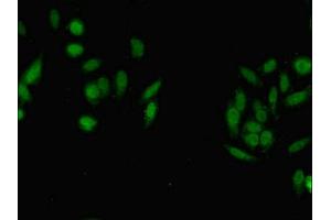 IHC analysis of paraffin-embedded human testis tissue, using ASH2L antibody. (ASH2L anticorps  (AA 1-534))