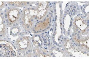 ABIN6277153 at 1/100 staining human kidney tissues  sections by IHC-P. (IL-10 anticorps  (Internal Region))