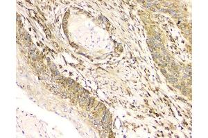 IHC analysis of Cyclophilin B using anti-Cyclophilin B antibody (ABIN6719475).