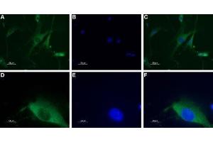 Expression of neuropeptide Y1 receptor in DRG neurons - Immunocytochemical staining of a primary culture of rat dorsal root ganglion (DRG) neurons.