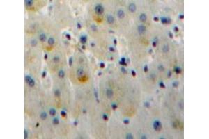 IHC-P analysis of Liver tissue, with DAB staining. (TLR6 anticorps  (AA 17-239))