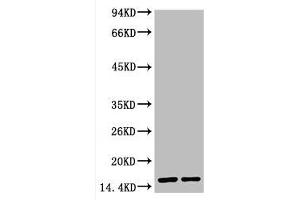 Western blot analysis of Hela, diluted at 1) 1:2000 2) 1:5000 (COX IV anticorps)