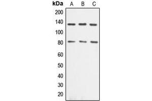 Western blot analysis of Alpha-adducin expression in Jurkat (A), HeLa (B), NIH3T3 (C) whole cell lysates. (alpha Adducin anticorps  (C-Term))