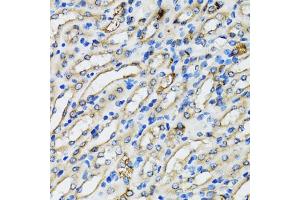 Immunohistochemistry of paraffin-embedded mouse kidney using COPB2 antibody (ABIN5974232) at dilution of 1/100 (40x lens). (COPB2 anticorps)
