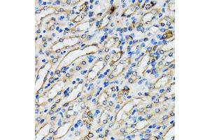 Immunohistochemistry of paraffin-embedded mouse kidney using COPB2 antibody (ABIN5974232) at dilution of 1/100 (40x lens).