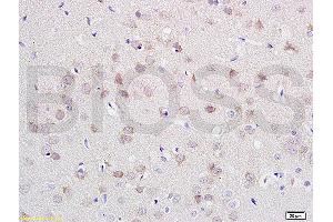 Formalin-fixed and paraffin embedded rat brain labeled with Anti-CDH2/N-cadherin Polyclonal Antibody, Unconjugated (ABIN738726) at 1:200 followed by conjugation to the secondary antibody and DAB staining. (N-Cadherin anticorps  (AA 701-800))