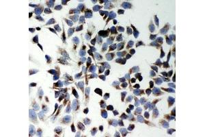 ICC: p62 antibody testing of HeLa cells