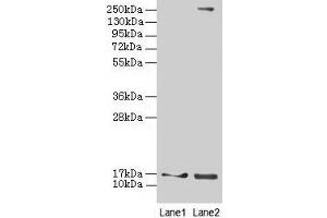Western blot All lanes: CRABP1 antibody at 4 μg/mL Lane 1: Mouse eye tissue Lane 2: THP-1 whole cell lysate Secondary Goat polyclonal to rabbit IgG at 1/10000 dilution Predicted band size: 16 kDa Observed band size: 16 kDa