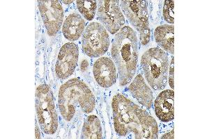 Immunohistochemistry of paraffin-embedded mouse kidney using TCP1 Rabbit pAb (ABIN6130046, ABIN6148956, ABIN6148957 and ABIN6217330) at dilution of 1:100 (40x lens). (TCP1 alpha/CCTA anticorps  (AA 307-556))