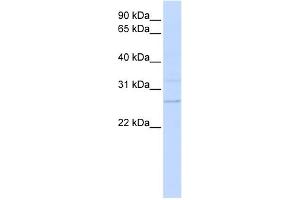 WB Suggested Anti-TMEM126B Antibody Titration:  0. (TMEM126B anticorps  (N-Term))