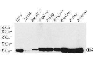 Western Blot analysis of various samples using FCGR3A Polyclonal Antibody at dilution of 1:800. (FCGR3A anticorps)