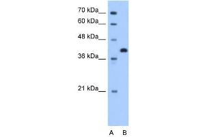 TOR2A antibody used at 1. (TOR2A anticorps  (N-Term))
