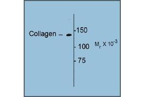 Image no. 1 for anti-Collagen, Type I (COL1) antibody (ABIN372600) (Collagen Type I anticorps)