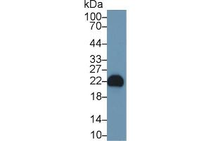 Detection of FGF12 in Rat Cerebrum lysate using Polyclonal Antibody to Fibroblast Growth Factor 12 (FGF12) (FGF12 anticorps  (AA 1-181))