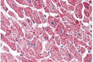 Human Heart (formalin-fixed, paraffin-embedded) stained with KPNA3 antibody ABIN337019 at 5 ug/ml followed by biotinylated anti-goat IgG secondary antibody ABIN481715, alkaline phosphatase-streptavidin and chromogen. (KPNA3 anticorps  (AA 509-521))
