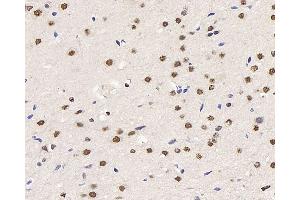 Immunohistochemistry analysis of paraffin-embedded rat brain using HES2 Polyclonal Antibody at dilution of 1:200.