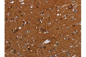 The image on the left is immunohistochemistry of paraffin-embedded Human brain tissue using ABIN7192423(SLC22A12 Antibody) at dilution 1/20, on the right is treated with synthetic peptide. (SLC22A12 anticorps)