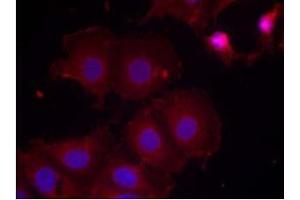 Image no. 2 for anti-Receptor tyrosine-protein kinase erbB-2 (ErbB2/Her2) (pTyr877) antibody (ABIN196748) (ErbB2/Her2 anticorps  (pTyr877))