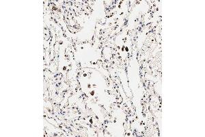Immunohistochemical analysis of paraffin-embedded human lung tissue using B performed on the Leica® BOND RXm.