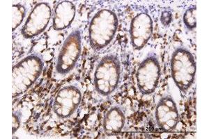 Image no. 3 for anti-B-Cell Receptor-Associated Protein 29 (BCAP29) (AA 125-241) antibody (ABIN599278) (BCAP29 anticorps  (AA 125-241))