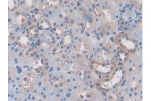 DAB staining on IHC-P; Samples: Rat Kidney Tissue