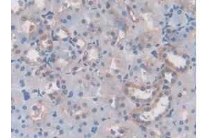 DAB staining on IHC-P; Samples: Rat Kidney Tissue (Laminin beta 3 anticorps  (AA 503-738))